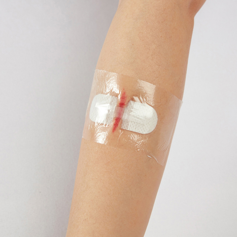 Bande adhésive stérile en poly - Medical Label avis et prix